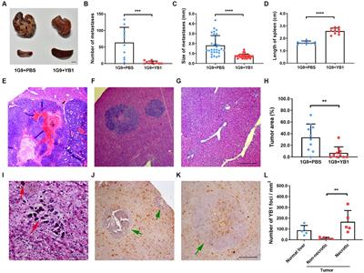 Targeted IFNγ induction by a genetically engineered Salmonella typhimurium is the key to the liver metastasis inhibition in a mouse model of pancreatic neuroendocrine tumor